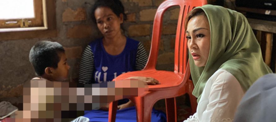 KETUA TP PKK KABUPATEN OKU SELATAN KUNJUNGI KORBAN LUKA BAKAR DI DESA GUNUNG TERANG KECAMATAN BUAY SANDANG AJI, MINTA TIM KESEHATAN PUSKESMAS BSA PANTAU MAULANA SAMPAI SEMBUH TOTAL